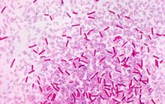 How can we come to a diagnosis of clostridium sordelli?