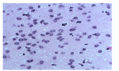 Moderate increase in cellularity 
Occasional nuclear atypia