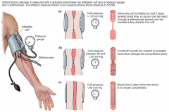 Can
       estimate arterial blood pressure in radial artery of arm 

Consisting
       of an inflatable cuff and a pressure gage 

Cuff
       encircles upper arm and is inflated until it exerts pressure higher than
       systolic pressure...