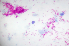 Mycobacterium spp
Actinomycetes
(red=positive)
