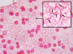 Campylobacter
Brachyspira
Fusobacterium
(stain red)
