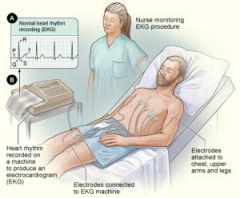 ELECTROCARDIÓGRAFO
Es un dispositivo electrónico que capta y amplía la actividad eléctrica del corazón a través de distintos electrodos colocados sobre el tórax e las extremidades del paciente. El registro obtenido se denomina electrocardio...