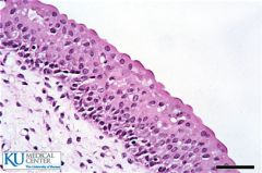Has several layers, but there is transitional shapes of cells from Cuboidal to Squamous; apical layer has dome shaped cells that may be binucleated.


The function is; Allows for distention or Stretching.