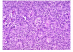 What is shown here? 
 
What do the nuclei resemble (something I drink a lot of)? What are the bodies called that have circular arrangements outside a sparsely cellular space recapitulating ovarian follice)?