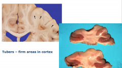 Firm areas in cortex