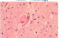 Tuber Histology