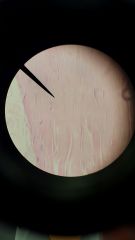 Collagen fibers densely arranged, with fibroblastsbetween them.  



The function is; Provides strong attachments.