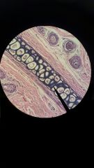 Chondrocytes in a  lacuna, with elastic fibers in the background, appears "dirty".

The functions are; Support & Maintain Shape.