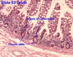 -Surface relatively smooth – no plicae or villi
-Crypts of Lieberkühn – present and longer than S.I.
-Columnar epithelium
 
	Goblet (mucous) cells more numerous than S.I.
	
	Endocrine cells: few in number
	
	Thin lamina propria
	
	Muscularis ...