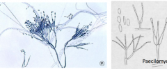 causes mycotic keratitis
Single,whorled, or penicillus-like elongated phialides that bear chains of oval conidia.
Paecilomyces-conidia are more widely divergent, phialides are more elongated. (Penicillium-conidia more parallel)
