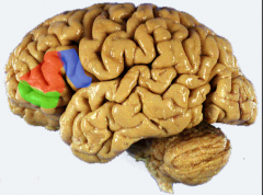 area 44 & 45

*pars trangularis (red) & pars opercularis (blue) (inferior frontal gyrus)

= motor area for speech in dominant hemisphere (left usually)