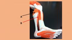 Which muscle is an antagonist to the 2 muscles shown below?