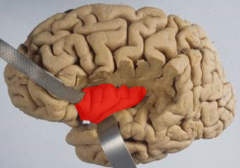 Secondary somatosensory cortex areas from the parietal lobe project to the __________