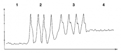 What is the Swan-Ganz waveforms in #1?