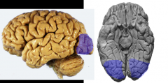 areas 18 & 19

*extrastriate cortex (occipital)

= processing of visual data to percieve motion, depth (binocular vision), color, & object position