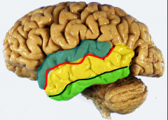 blue= superior temporal gyrus
red= superior temporal sulci
yellow= middle temporal gyrus
black= inferior temporal sulcus
green= inferior temporal gyrus