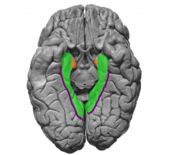 Identify gyrus & sulci of the ventral limbic lobe