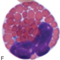 granulocyte
segmented nucleus - usually 2 lobes
larger than neutrophil
allergy and parasites
