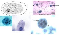 Identify and describe Entamoeba histolytica cyst and trophozoites