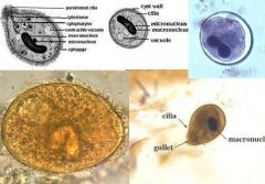 Balantidium coli trophozoite (feeding) and cyst (resistant) stages