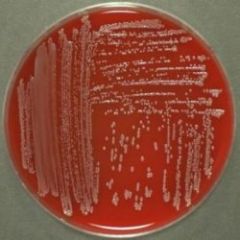 Citrobacter freundii