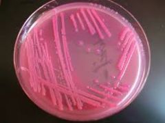 E. coli