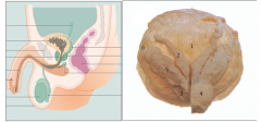 Ampulla – distal, dilated portion of ductus deferens (2)
Connects with duct from seminal vesicle (5), forms ejaculatory duct (3)