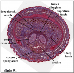 • Corpus cavernosum 
• Corpus spongiosum = corpus cavernosum urethrae 
• Tunica albuginea = dense fibroelastic tissue; surrounds each erectile body
