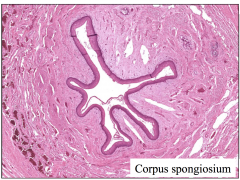  • vascular lacunae – lined by endothelium 
• fibroelastic tissue containing smooth muscle 
• Corpus spongiosum – more connective tissue,
less turgid