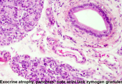 This is a histologic slide of Juvenile Pancreatic atrophy. 



This is most commonly seen in what breeds?