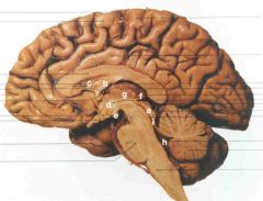 where is the thalamus and which ventricle does it enclose?