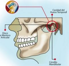 La articulación temporomandibular que se forma entre los huesos temporal (cavidad glenoidea) y  la mandíbula (cóndilo articular o cabeza de la mandíbula).