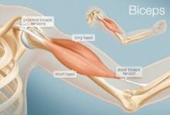 ¿Qué tipo de músculo es el bíceps que encontramos en el brazo?