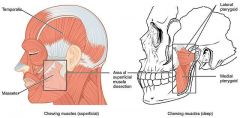 En clase estudiamos 4 músculos de la masticación:
- Temporal.
- Masetero.
- Pterigoideo interno.
- Pterigoideo externo.