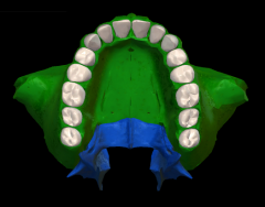 Por cuatro huesos: 2 maxilares superiores (apófisis palatinas) y 2 huesos palatinos.