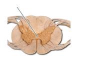 located in the center of the gray commissure; extends the entire length of the spinal cord & contains CSF.