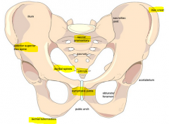 -Pubic bone ( pubic symphysis, Pubic arch, Superior/inferiour pubic Rami ) 


 


-Ischium ( Ischial tuberosity, Ischial spine)


 


-Ilium (ASIS/PSIS, Iliac crest) 


 


-Pelvic brim


-Sacral promontory 