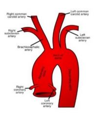-R/L coronary arteries
-Brachiocephalic artery
-L common carotid artery
-L subclavian artery