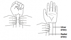 Test for patency of ulnar artery prior to placing a radial arterial line or perform- ing an ABG: Examiner occludes both ulnar and radial arteries with fingers as patient makes fist; patient opens fist while examiner releases ulnar artery occlusion...