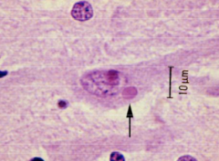 What is the arrow pointing to in the cell?


Where can these be located within the cell?