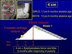 The calculated discrepancy at maturity is given as 3cm of shortening. Epiphysiodesis is the typical answer for growth differences between 2 and 5 cm.Ans4