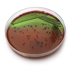 Eosin Methylene Blue Agar (EMB) is both selective and differential.  EMB selects for G(+) bacteria.  EMB also differientiates b/w lactose fermenting and nonfermenting bacteria.  Lactose fermenting bacteria will produce dark purple colonies or prod...