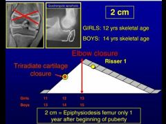 assumes that girls and boys stop growing at 14 yo and 16 yo, respectively. Additionally, this method assumes a certain contribution of each physis to longitudinal annual growth:
Proximal femur – 4mm per year
Distal femur – 10mm per year
Pro...
