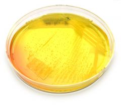 Mannitol Salt Agar (MSA) is both selective and differential.  MSA contains 7.5% NaCL and selects for SALT TOERANT bacteria. MSA also contains the carbohydrate mannitol and the pH indicator phenol red.  

If your unknown is able to grow on MSA an...