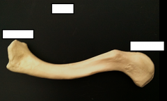 What bone is this?
Left or right?