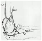predominant blood supply to the lateral condyle of the distal humerus comes posteriorly. Nonunions occur because of these fractures are intra-articular and bathed in synovial fluid. When nonunions occur, the characteristic deformity is a cubitus v...