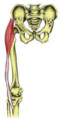 O: ASIS & iliac crest


 


I: ITB


 


A: hip flexion, ABD & IR


 


N: superior gluteal nerve