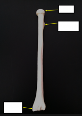 What bone is this?
Left or Rright?