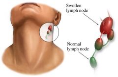 how do Lymph Nodes tend to appear?