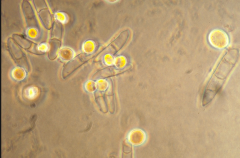 fusarium, microspore is small single cell